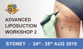 Advanced Liposuction Workshop 2