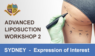 Advanced Liposuction Workshop 2